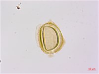 烏毛蕨藏品圖，第2張