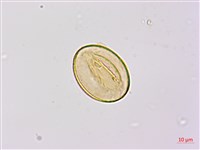 烏毛蕨藏品圖，第3張