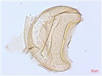 細柄雙蓋蕨藏品圖，第3張