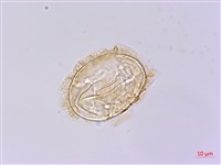 樸氏雙蓋蕨、毛柄蹄蓋蕨藏品圖，第1張