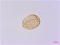 樸氏雙蓋蕨、毛柄蹄蓋蕨藏品圖，第2張