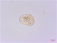 樸氏雙蓋蕨、毛柄蹄蓋蕨藏品圖，第3張