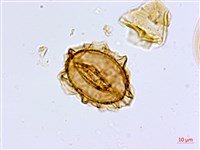 山蘇花藏品圖，第3張