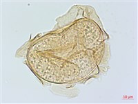 大葉雙蓋蕨、大羽雙蓋蕨藏品圖，第2張