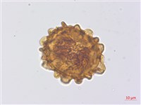 腺毛腫足蕨藏品圖，第3張