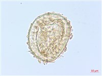 單葉雙蓋蕨藏品圖，第3張