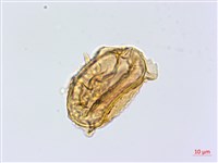 深山雙蓋蕨藏品圖，第2張