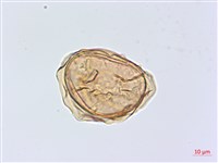 深山雙蓋蕨藏品圖，第3張