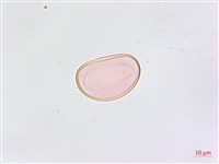 鱗柄鐵角蕨藏品圖，第2張