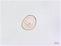 鱗柄鐵角蕨藏品圖，第3張