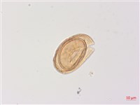 高山蹄蓋蕨藏品圖，第1張