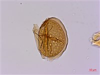 長苞雙蓋蕨、鱗柄雙蓋蕨藏品圖，第2張