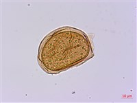 長苞雙蓋蕨、鱗柄雙蓋蕨藏品圖，第3張