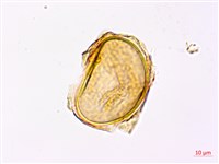 哈氏狗脊蕨藏品圖，第3張