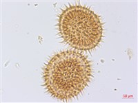 頂囊擬鱗毛蕨藏品圖，第3張