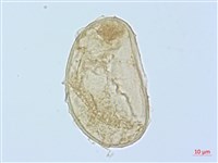 德氏雙蓋蕨藏品圖，第1張