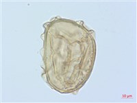 德氏雙蓋蕨藏品圖，第3張