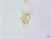 烏毛蕨藏品圖，第3張