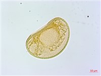 薄葉蹄蓋蕨藏品圖，第2張