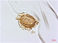 假耳羽雙蓋蕨藏品圖，第2張