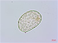 小膜蓋蕨藏品圖，第1張