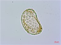 小膜蓋蕨藏品圖，第2張