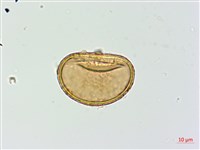 擬溪谷蹄蓋蕨藏品圖，第2張