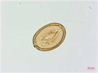 擬溪谷蹄蓋蕨藏品圖，第3張