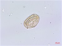 擬德氏雙蓋蕨藏品圖，第3張