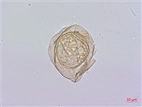 細鱗雙蓋蕨、褐鱗雙蓋蕨藏品圖，第2張