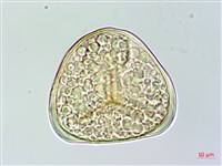 菲律賓金狗毛蕨藏品圖，第3張