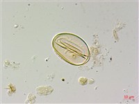 長柄牙蕨藏品圖，第1張