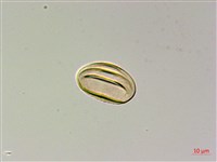 長柄牙蕨藏品圖，第2張