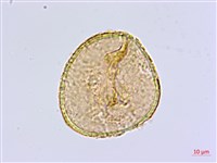 長蓋鐵線蕨藏品圖，第2張