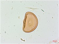 假軸果蹄蓋蕨、毛軸蹄蓋蕨藏品圖，第2張