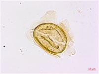 烏毛蕨藏品圖，第2張