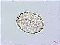 小膜蓋蕨藏品圖，第1張