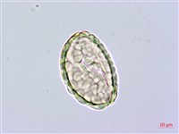 小膜蓋蕨藏品圖，第2張