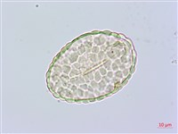 小膜蓋蕨藏品圖，第3張