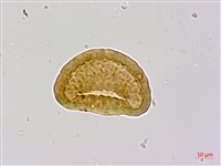 細裂小膜蓋蕨藏品圖，第3張