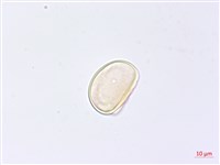 巢形軸鱗蕨藏品圖，第1張