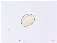 巢形軸鱗蕨藏品圖，第2張