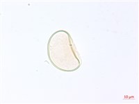 巢形軸鱗蕨藏品圖，第3張