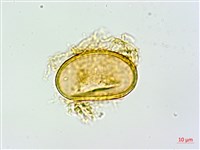 姬蹄蓋蕨、溪谷蹄蓋蕨藏品圖，第2張