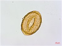 姬蹄蓋蕨、溪谷蹄蓋蕨藏品圖，第3張