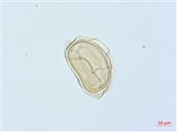 廣葉鋸齒雙蓋蕨藏品圖，第3張