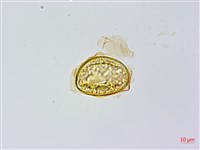 烏毛蕨藏品圖，第2張