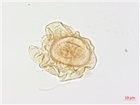 黃腺羽蕨藏品圖，第3張