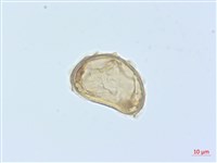 廣葉鋸齒雙蓋蕨藏品圖，第3張