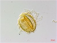 南投三叉蕨藏品圖，第1張